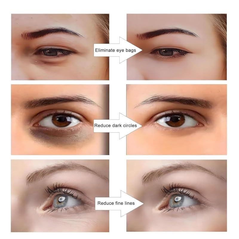 Under-Eye LED Therapy Mask